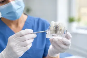Guida all’osso insufficiente per impianti
