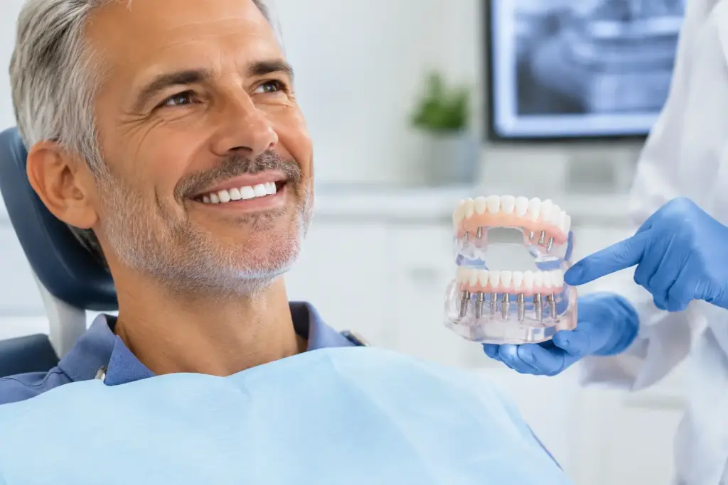 Come funziona All-on-4 per denti fissi?